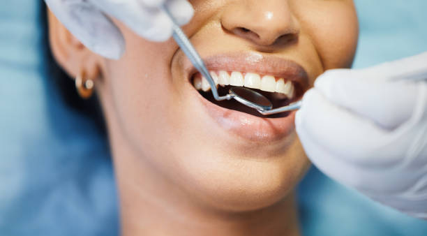 Best Emergency Tooth Extraction in North Highlands, CA